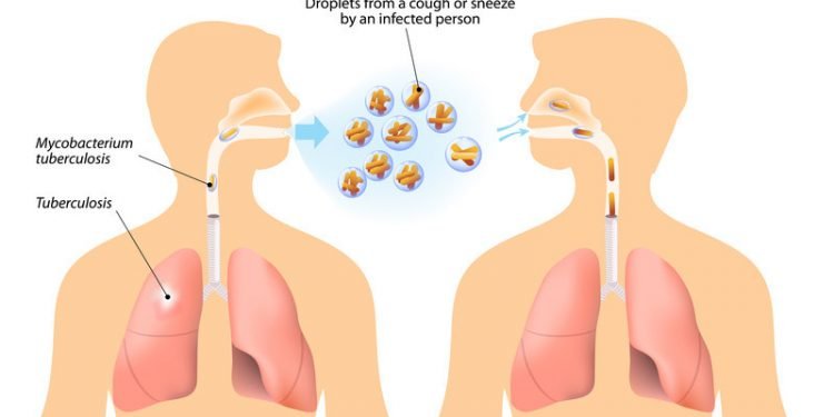 Badigad rural municipality records 111 TB patients