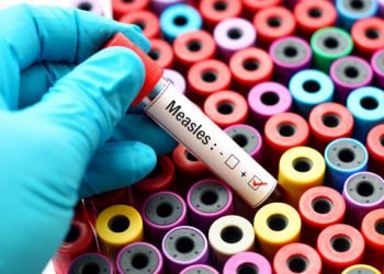 Measles cases detected in Jhapa